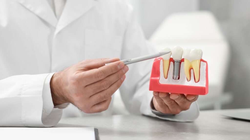 Pianificazione implantare e progetto protesico