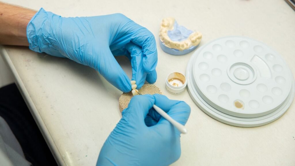 PATOLOGIA INFIAMMATORIA DELLE GHIANDOLE SALIVARI